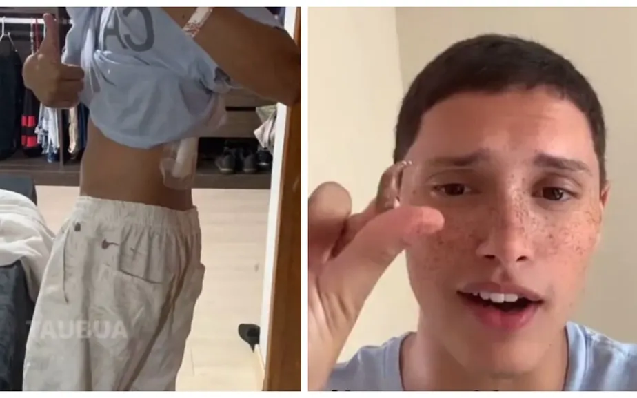 “Pensei que tivesse tomado um tapa”: Jovem leva tiro de raspão enquanto dormia na Zona Norte do Rio e viraliza nas redes sociais